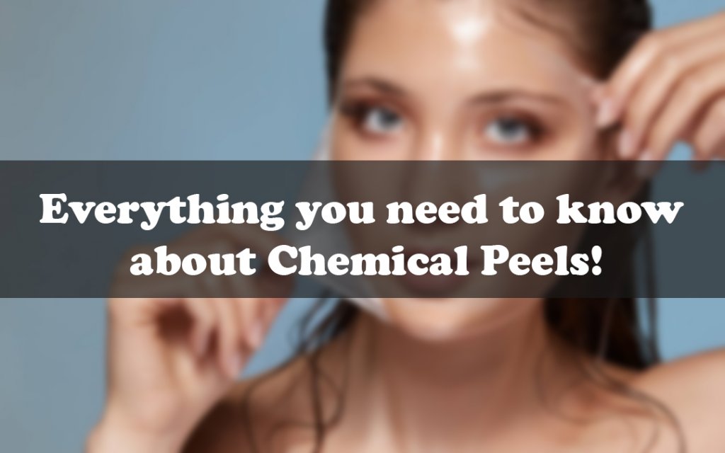Everything you need to know about Chemical Peels!
