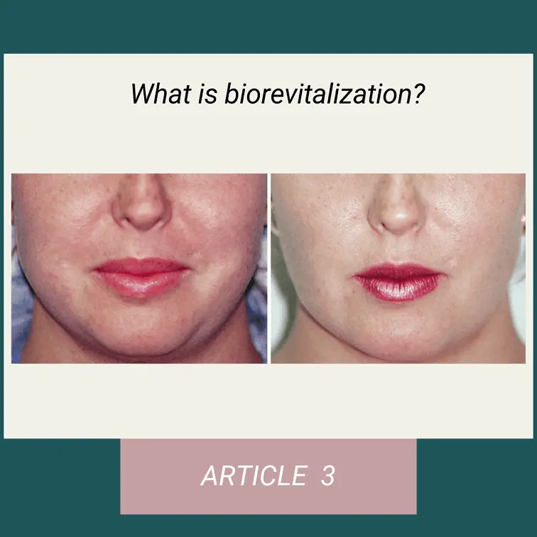 What is biorevitalization?
