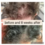 Atlantis Hair Exosomes 5 ml x 10 vials - Image 5